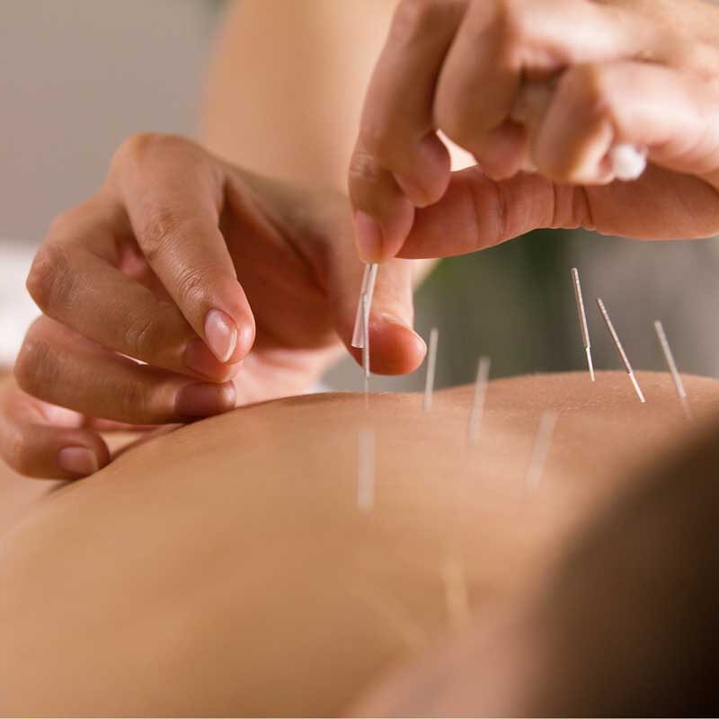 nourishing-life-healing-sessions-acupuncture